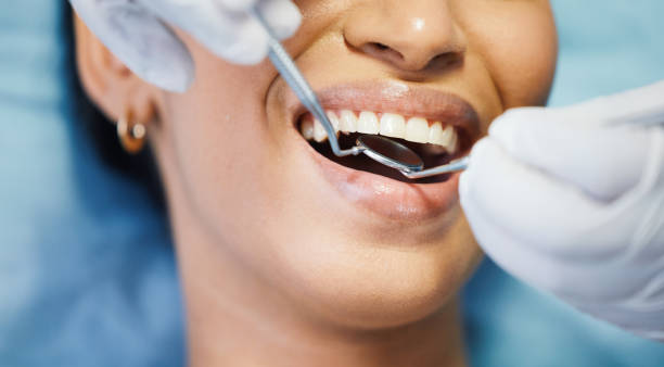 Best Emergency Root Canal Treatment in Ellsworth, WI