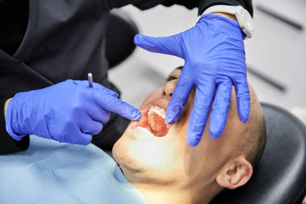 Best Emergency Dental Care for Broken or Chipped Teeth in Ellsworth, WI